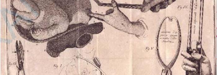 Imatge extreta de Bertrandi, Giovanni Ambrogio MariaOpere di Ambrogio Bertrandi. Torino: presso i fratelli Reycends,  1786-1799.11 v.