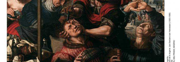 Reproducció del quadre "Extracció de la pedra de la bogeria. Jan Sanders van Hemessen (1500-1566)". Imatge extreta del llibre "Martí Vilalta JL, Neurología en el arte. [Barcelona]: Lunwerg, 2007."
